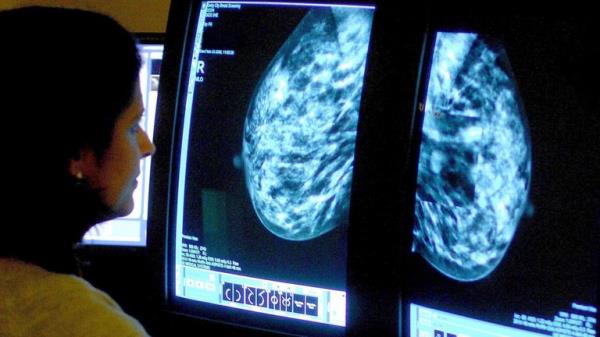 A co<em></em>nsultant analysing a mammogram