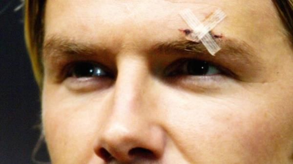 A plaster is visible over the injured left eyebrow of Manchester United mid-fielder David Beckham, during the team line-up, before kick-off in the UEFA Champions League group D match against Juventus at Old Trafford, Manchester. *  The rumoured rift between David Beckham and his club boss Sir Alex Ferguson looked dead and buried today after the midfield maestro helped Manchester United to a vital European victory. Just days after a dressing room bust-up saw Sir Alex accidentally kick a football boot into Beckham&#39;s face, cutting him above the eye, the pair at last had something to smile a<em></em>bout. The Old Trafford side beat visitors and Italian giants Juventus in the Champions League 2-1 last night with Beckham providing the crucial ball for both home goals.